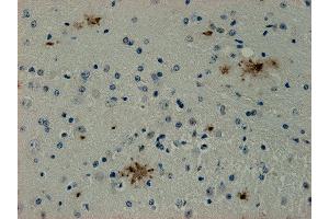 Immunostaining of paraffin embedded sections from mouse brain area containing Alzheimer plaques (dilution 1 : 1000). (SDCBP 抗体)