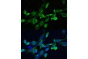 Immunofluorescence analysis of NIH-3T3 cells using SQS/FDFT1 antibody (ABIN6130393, ABIN6140567, ABIN6140568 and ABIN6221824) at dilution of 1:100. (FDFT1 抗体  (AA 1-260))