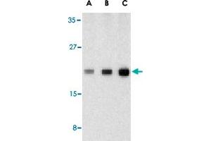 Western blot analysis of CASP1 in human heart tissue lysate with CASP1 polyclonal antibody  at (A) 0. (Caspase 1 抗体  (C-Term))