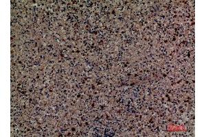 Immunohistochemistry (IHC) analysis of paraffin-embedded Human Spleen, antibody was diluted at 1:100. (CD58 抗体  (Internal Region))