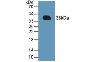 Detection of Recombinant MCL1, Mouse using Polyclonal Antibody to Induced Myeloid Leukemia Cell Differentiation Protein Mcl-1 (MCL1) (MCL-1 抗体  (AA 2-307))