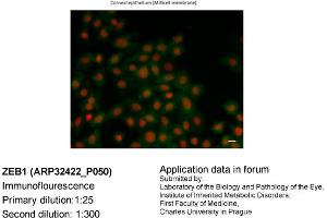 Image no. 2 for anti-Zinc Finger E-Box Binding Homeobox 1 (ZEB1) (N-Term) antibody (ABIN2779631) (ZEB1 抗体  (N-Term))