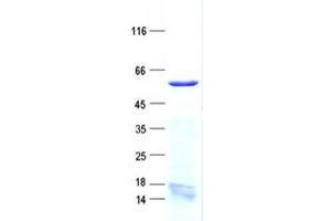 Western Blotting (WB) image for Elongation Factor RNA Polymerase II-Like 3 (ELL3) protein (His tag) (ABIN5505624)