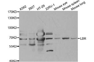 Western Blotting (WB) image for anti-Lamin B Receptor (LBR) antibody (ABIN1876656) (Lamin B Receptor 抗体)