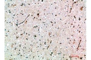 Immunohistochemical analysis of paraffin-embedded human-brain, antibody was diluted at 1:200 (AVPR1B 抗体  (AA 271-320))