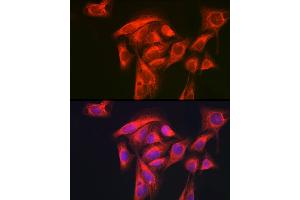 Immunofluorescence analysis of U-2 OS cells using GART Rabbit pAb (ABIN1679954, ABIN3018225, ABIN3018226 and ABIN6220407) at dilution of 1:200 (40x lens). (GART 抗体  (AA 1-320))