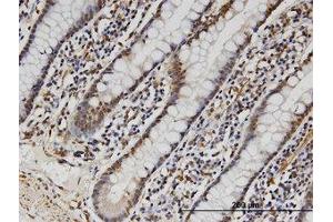 Image no. 1 for anti-Family with Sequence Similarity 3, Member B (FAM3B) (AA 1-236) antibody (ABIN599570) (FAM3B 抗体  (AA 1-236))