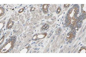 ABIN6277500 at 1/100 staining Human prostate tissue by IHC-P. (EIF4A1 抗体  (N-Term))
