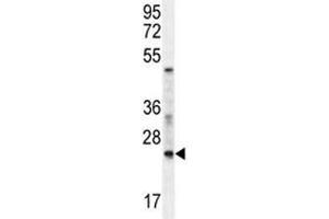 RAN antibody western blot analysis in mouse NIH3T3 lysate. (RAN 抗体  (AA 112-140))