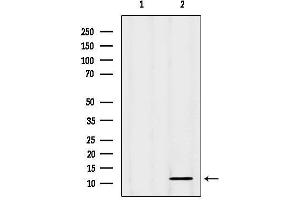 anti-Cystatin A (Stefin A) (CSTA) (C-Term) antibody