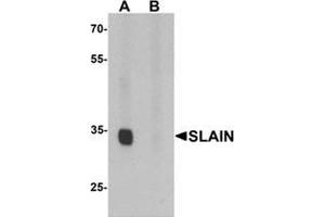 Western blot analysis of SLAIN1 in A549 cell lysate with SLAIN1 antibody at 1 ug/mL in (A) the absence and (B) the presence of blocking peptide. (SLAIN1 抗体  (C-Term))