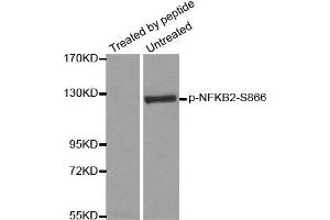 Western blot analysis of extracts from ovary cancer cells, using Phospho-NFKB2-S866 antibody.