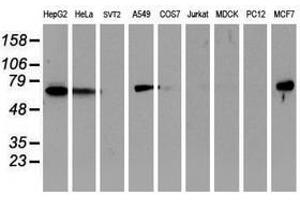 Image no. 3 for anti-Epsin 2 (EPN2) antibody (ABIN1498051) (Epsin 2 抗体)