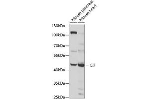 Western blot analysis of extracts of various cell lines, using GIF antibody (ABIN6130975, ABIN6141081, ABIN6141082 and ABIN6222649) at 1:1000 dilution. (Intrinsic Factor 抗体  (AA 20-300))