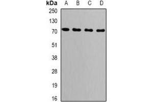 Western blot analysis of GRP75 expression in MCF7 (A), NIH3T3 (B), COS7 (C), mouse brain (D) whole cell lysates. (HSPA9 抗体)