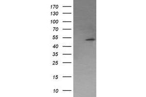 Image no. 5 for anti-Protein Phosphatase, Mg2+/Mn2+ Dependent, 1B (PPM1B) antibody (ABIN1500371) (PPM1B 抗体)