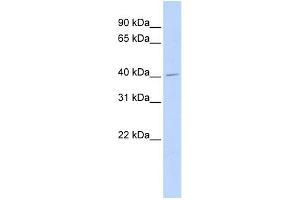 WB Suggested Anti-ASAHL Antibody Titration:  0. (NAAA 抗体  (Middle Region))