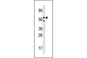 Western blot analysis of anti-URKL1 Pab in 293 cell line lysate (35 µg/lane). (UCKL1 抗体  (N-Term))