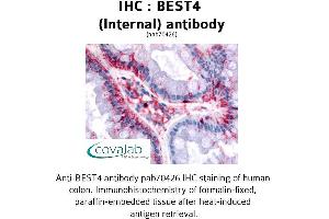 Image no. 1 for anti-Bestrophin 4 (BEST4) (Internal Region) antibody (ABIN1732305) (Bestrophin 4 抗体  (Internal Region))