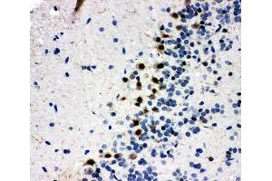 IHC-P: MYBL2 antibody testing of rat brain tissue