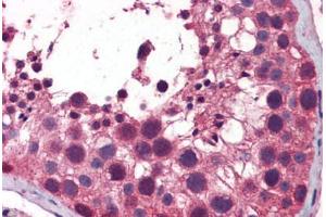 Human Testis: Formalin-Fixed, Paraffin-Embedded (FFPE) (TBK1 抗体  (AA 74-123))