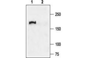 Western blot analysis of rat lung membranes: - 1. (CFTR 抗体  (C-Term, Cytosolic))