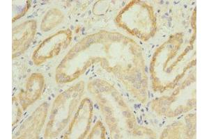 Immunohistochemistry (IHC) image for anti-Cleavage and Polyadenylation Specific Factor 4, 30kDa (CPSF4) (AA 1-244) antibody (ABIN7147920)