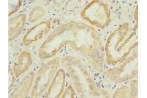 Immunohistochemistry of paraffin-embedded human kidney tissue using ABIN7147920 at dilution of 1:100 (CPSF4 抗体  (AA 1-244))