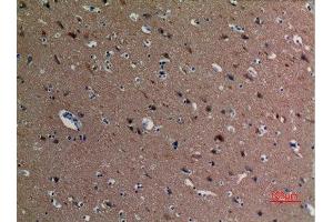 Immunohistochemistry (IHC) analysis of paraffin-embedded Human Brain, antibody was diluted at 1:100. (alpha Tubulin 抗体  (acLys40))