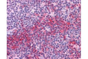 Immunohistochemistry (IHC) image for anti-SRY (Sex Determining Region Y)-Box 2 (SOX2) (N-Term) antibody (ABIN2777428)