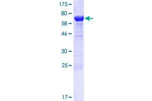 Image no. 1 for MTOR associated protein, eak-7 homolog (MEAK7) (AA 1-456) protein (GST tag) (ABIN1308627) (KIAA1609 Protein (AA 1-456) (GST tag))