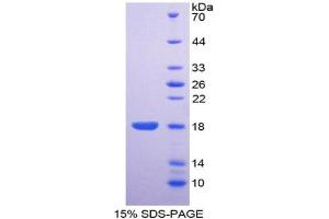 SDS-PAGE analysis of Human ENPP1 Protein. (ENPP1 蛋白)