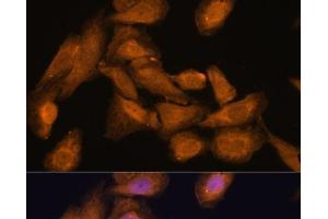 Immunofluorescence (IF) image for anti-Ribosomal Protein L27 (RPL27) antibody (ABIN7256554)