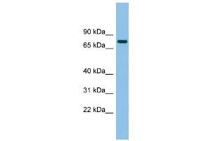 WB Suggested Anti-MTMR14 Antibody Titration: 0. (MTMR14 抗体  (Middle Region))