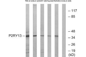 Western blot analysis of extracts from HeLa cells, COLO cells, HT-29 cells, HepG2 cells and HUVEC cells, using P2RY13 antibody. (Purinergic Receptor P2Y, G-Protein Coupled, 13 (P2RY13) (Internal Region) 抗体)