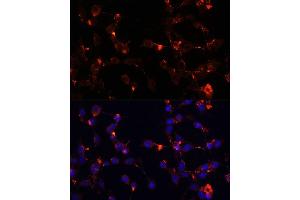 Immunofluorescence analysis of NIH/3T3 cells using WDR81 antibody (ABIN6294099) at dilution of 1:100. (WDR81 抗体)