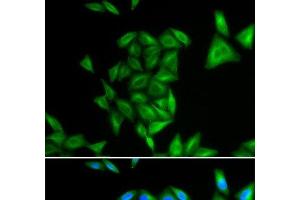 Immunofluorescence analysis of U2OS cells using PHYH Polyclonal Antibody (PHYH 抗体)