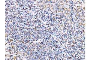 Immunohistochemistry (IHC) image for anti-Aconitase 2, Mitochondrial (ACO2) (AA 501-780) antibody (ABIN1678537)