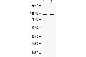 Western blot analysis of AKAP2 expression in rat cardiac muscle extract ( Lane 1) and HEPG2 whole cell lysates ( Lane 2). (AKAP2 抗体  (C-Term))