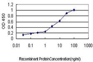 Detection limit for recombinant GST tagged SERPING1 is approximately 0.