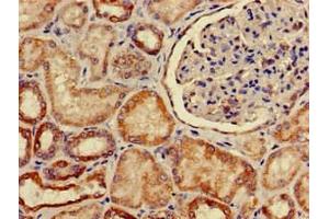 Immunohistochemistry (IHC) image for anti-Solute Carrier Family 2 (Facilitated Glucose Transporter), Member 9 (SLC2A9) (AA 473-511) antibody (ABIN7170127)