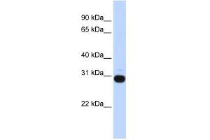 Vasohibin 1 antibody used at 1 ug/ml to detect target protein. (VASH1 抗体  (Middle Region))