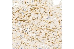 Immunohistochemistry of paraffin-embedded rat brain using Myelin Basic Protein Rabbit pAb (ABIN3022348, ABIN3022349, ABIN3022350 and ABIN6218754) at dilution of 1:100 (40x lens). (MBP 抗体  (AA 1-197))