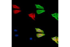 ABIN6260453 and ABIN6279232 staining Hela cells by IF/ICC. (CAPNS2 抗体  (Internal Region))