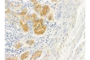 ABIN6258944 and ABIN6275125 at 1/100 staining human normal gastric tissue by IHC-P. (FKBPL 抗体  (Internal Region))