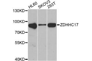 Western blot analysis of extracts of various cell lines, using ZDHHC17 antibody (ABIN2560820) at 1:1000 dilution. (ZDHHC17 抗体)