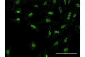 Immunofluorescence of monoclonal antibody to PQBP1 on HeLa cell. (PQBP1 抗体  (AA 1-265))