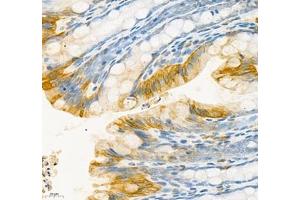 Immunohistochemistry (Paraffin-embedded Sections) (IHC (p)) image for anti-Carcinoembryonic Antigen-Related Cell Adhesion Molecule 1 (CEACAM1) antibody (ABIN7073315)