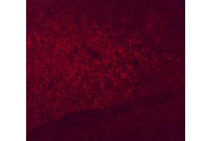 Immunofluorescence (IF) image for anti-Sine Oculis-Related Homeobox 3 (SIX3) (Internal Region) antibody (ABIN6657910)