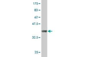 Western Blot detection against Immunogen (36. (CDK17 抗体  (AA 426-523))